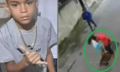 criança atacada pitbull