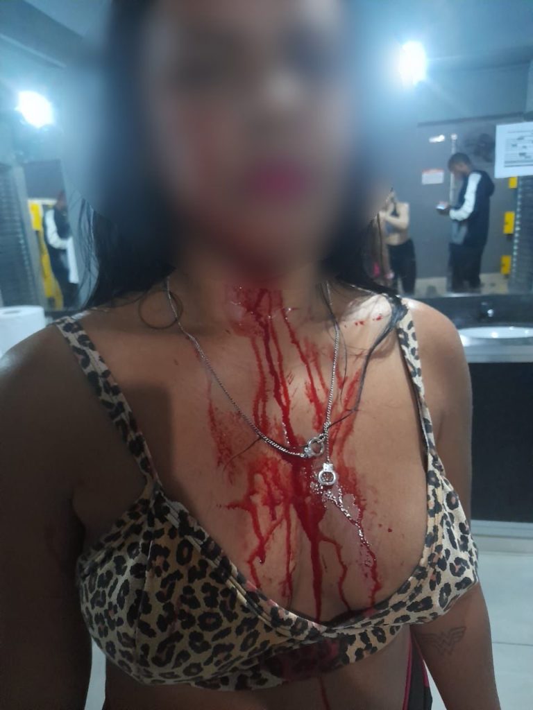 Mulher tem maxilar fraturado após ser agredida por empresário em academia da Zona Norte