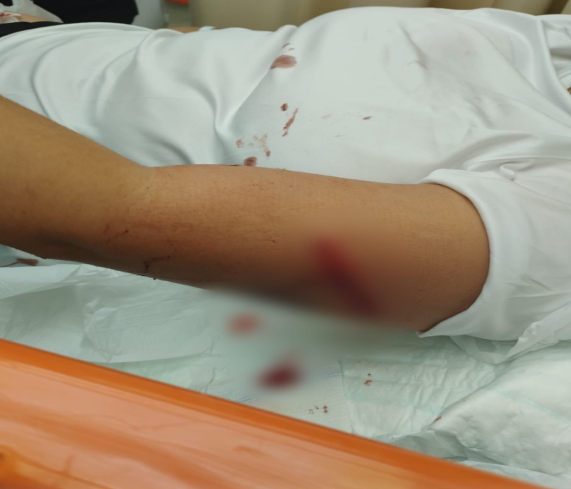 Vítima ficou ferida no braço | Foto: Divulgação