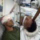 Homem sobrevive após estaca perfurar crânio em acidente de trabalho em Mangaratiba.