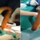 Médicos fazem cirurgia para retirar enguia viva de 60cm do corpo de paciente no Vietnã.