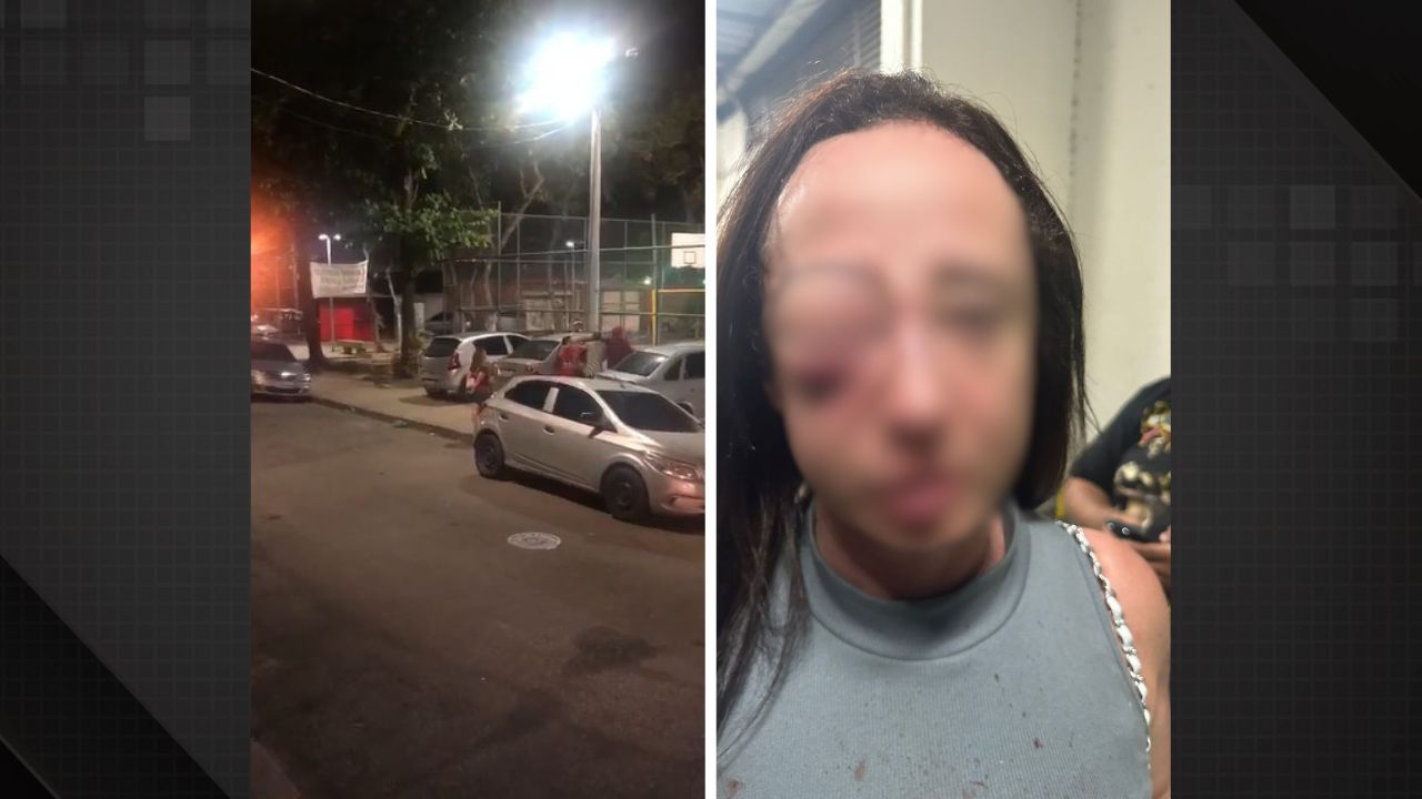 Professora é agredida após discussão em estacionamento na Zona Oeste.