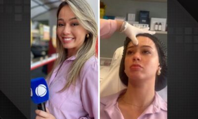 Jornalista faz publicidade de botox com logomarca da Record e é demitida