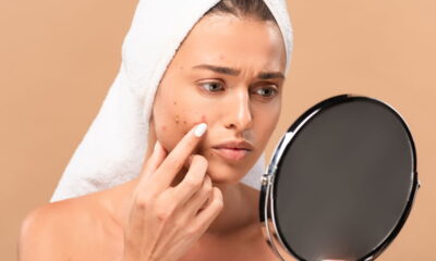 Como manter sua pele livre de acne interna: Prevenção e tratamento