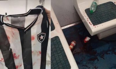 Torcedores do Botafogo relatam ataque de organizadas do Flamengo nos trens e pessoas feridas após jogo com Fortaleza