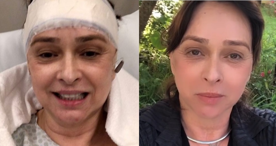 Myriam Rios no hospital depois de cirurgia na cabeça