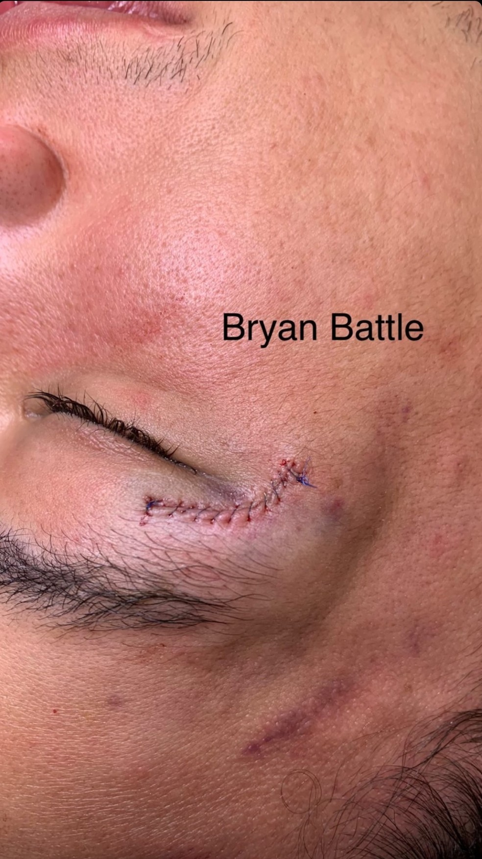 Bryan Battle depois