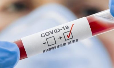 Teste positivo para Covid-19