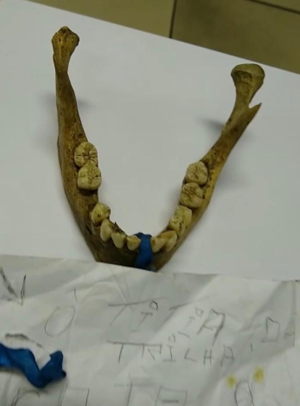 arcada dentária encontrada em trilha